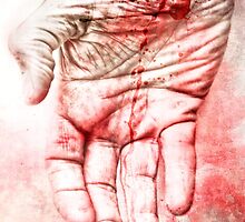 Hurt by Bob Daalder