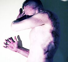 The Disease Spreads by anthylorrel