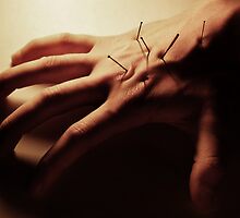 Pins and Needles by Kristian D'Amato