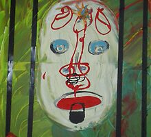Cerebral infarction by teilvdnaz