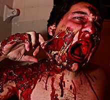 Painful, Don't you think? by Allen Blair III