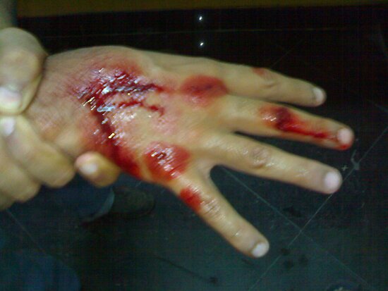 Love And Pain. blood love hand pain by
